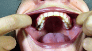 www.xsiteability.com - Get Deep Inside Brenda Bound's Mouth thumbnail